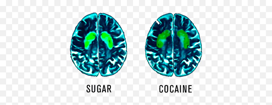 Blog U2014 Total Wellness Resource Center - Sugar Cocaine Emoji,Brief Emotion Report Diener Emmons 1985