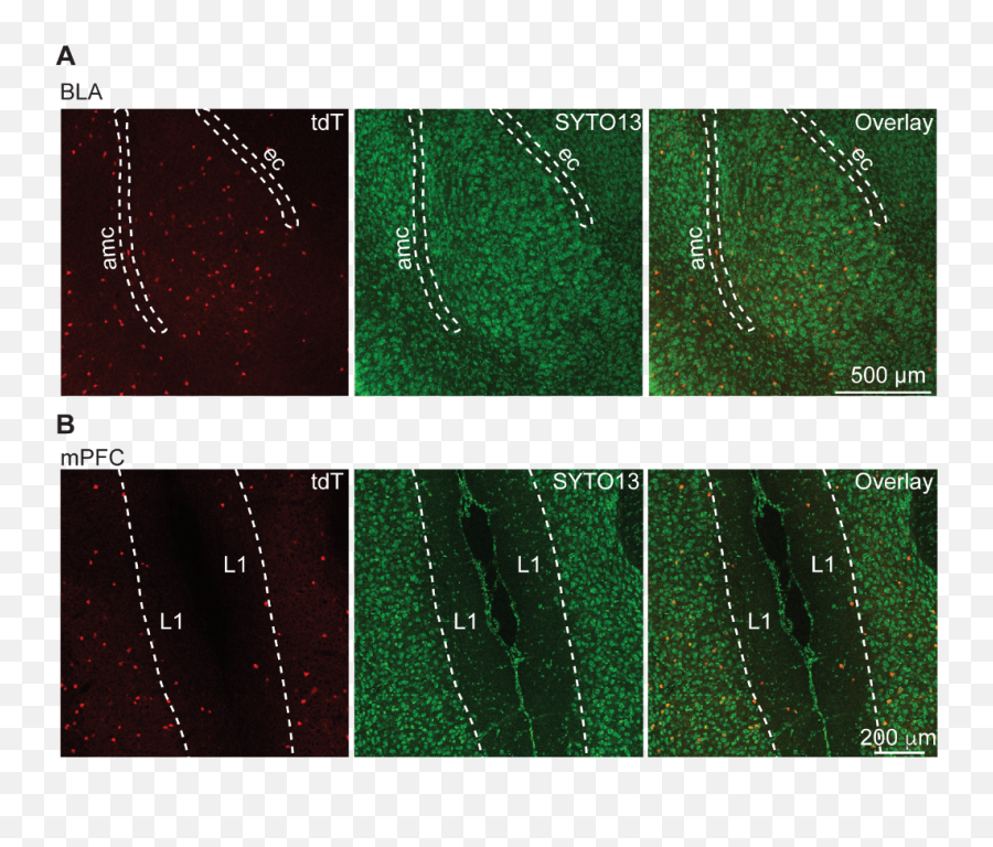 Obm Neurobiology N - Type Calcium Channels Control Gabaergic Dot Emoji,Mental Illness Resulting From Inexpression Of Emotions