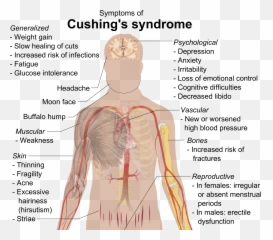 Glucocorticoidpharmacology Tusom Pharmwiki - Features Of Cushing Syndrome Emoji,Effects Of Full Moon On Emotions