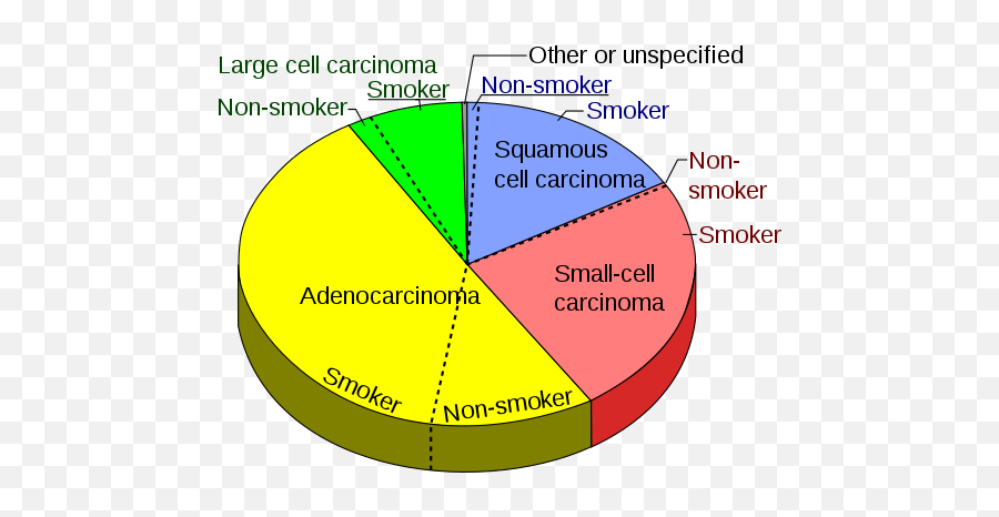 Lung Cancer - Wikiwand Lung Cancer Pie Charts Emoji,Advan Emotion Test Pipe S13