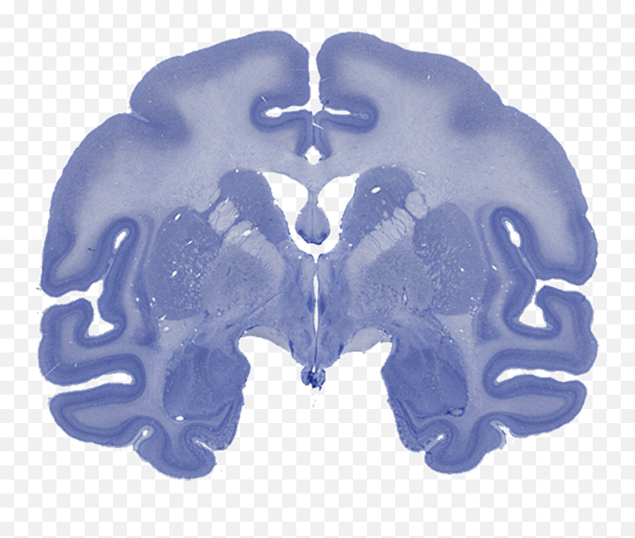 Research U2014 The Bliss - Moreau Laboratory Emoji,Emotions Shape What We See