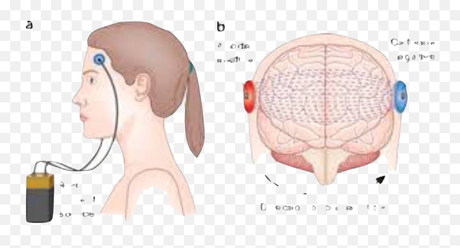 Electric Stim U2014 Brainhopecom Emoji,Emotion Rating Scale Aphasia