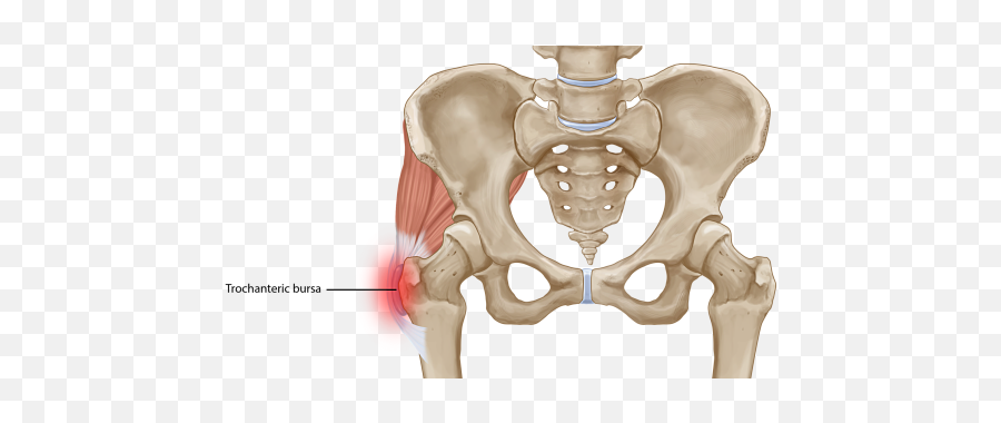 What Do People Notice In Walking Style - Quora Trochanteric Bursitis Emoji,Right Leg Emotion