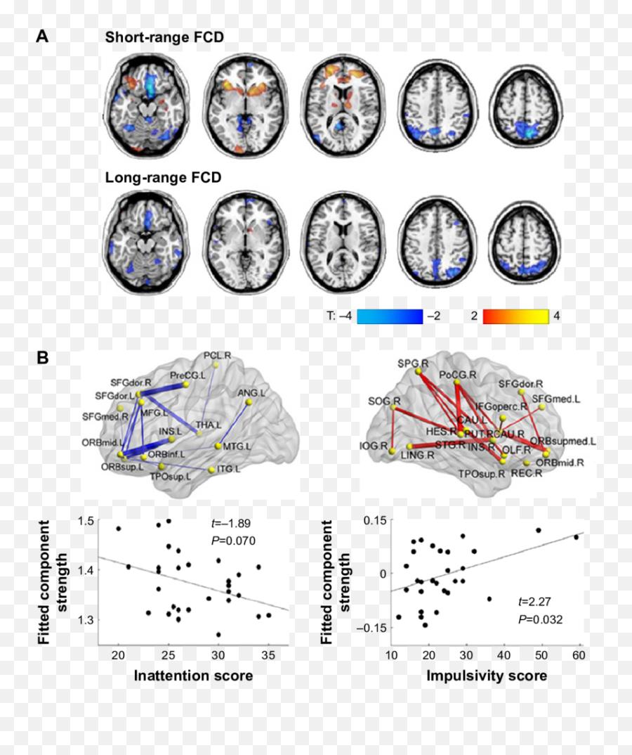 Disturbed Connectivity In Adhd Notes A Decreased Or - Adhd Functional Connectivity Emoji,Aristotle Four Causes Emotions