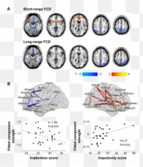 Disturbed Connectivity In Adhd Notes A Decreased Or - Adhd Functional Connectivity Emoji,Aristotle Four Causes Emotions