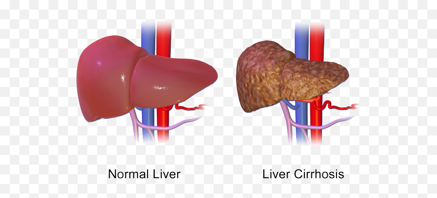 Top 7 Benefits Of Tudca The U201cbearu201d Of Liver Biohacks By Emoji,Liver Emotion