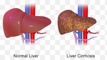 Top 7 Benefits Of Tudca The U201cbearu201d Of Liver Biohacks By Emoji,Liver Emotion
