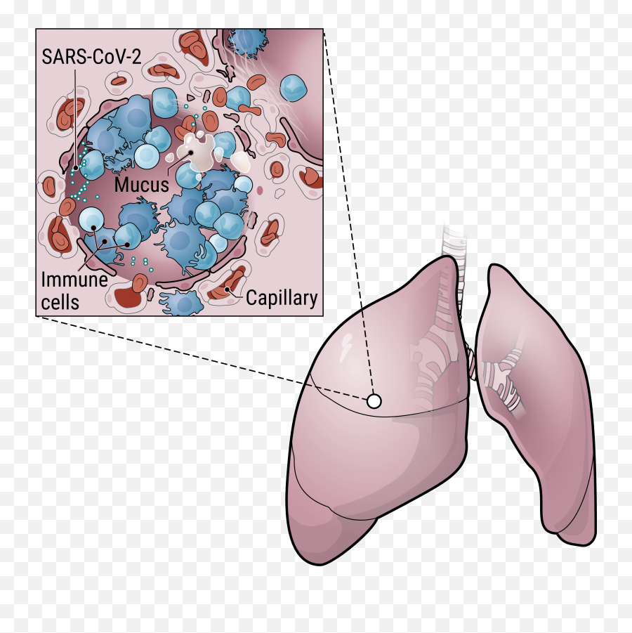 How Does Coronavirus Kill Clinicians Trace A Ferocious - Liver Emoji,How Your Emotions Affect Your Body Organs