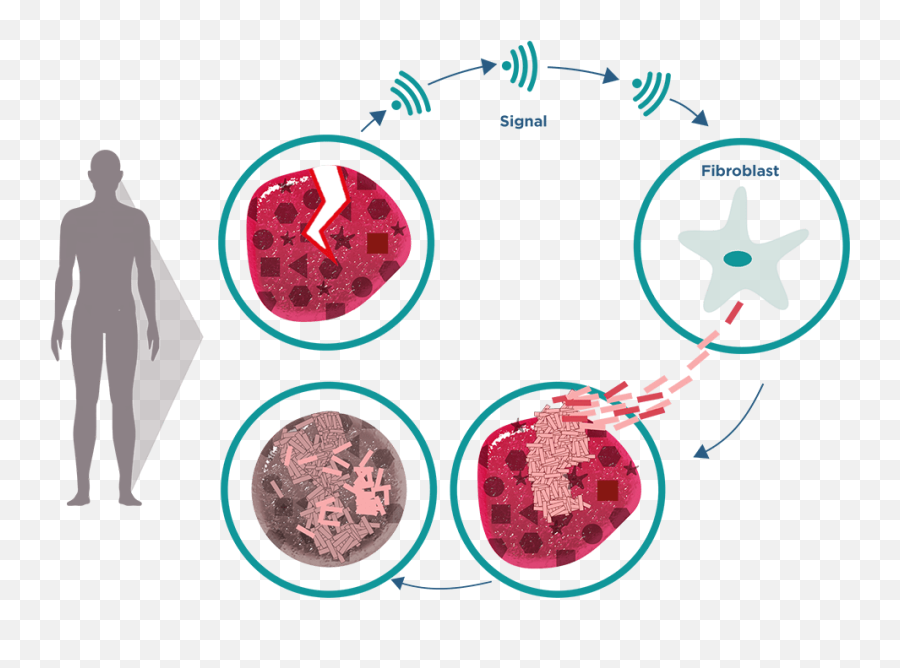 What Is Scleroderma Systemic Sclerosis More Than Scleroderma - For Adult Emoji,How Your Emotions Affect Your Body Organs