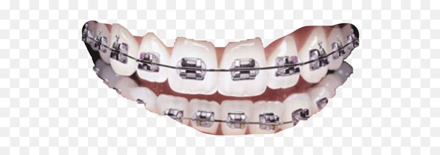 Clear Wire Sticker - Smiles Braces Emoji,Pics Of Emoji Teeth With Braces