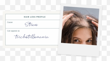 The Most Common Causes Of Female Hair Loss Monpure Uk - Hair Design Emoji,Five Little Pumpkins Emotion
