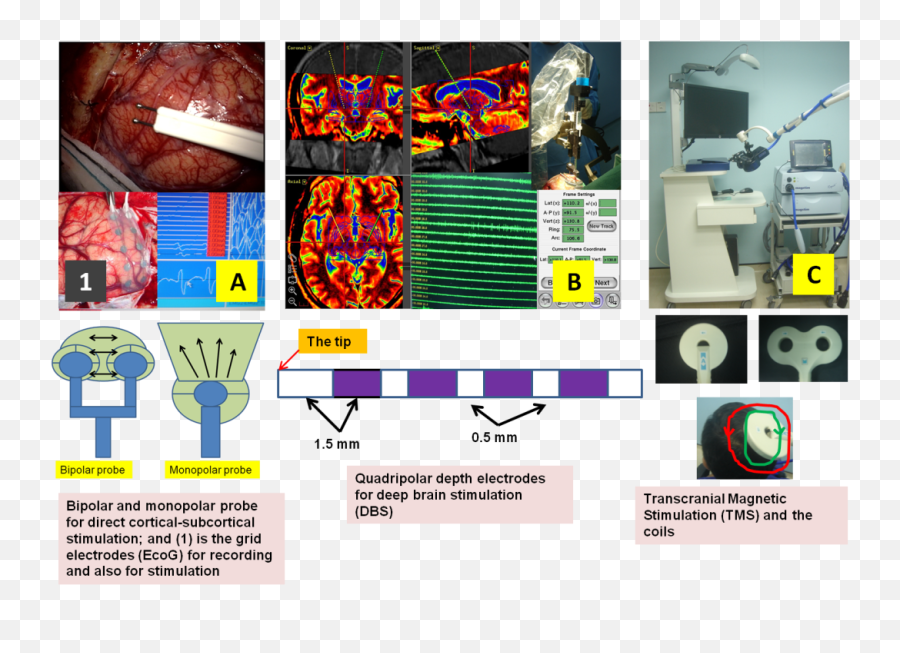 Functional Mri Diffusion Tensor Imaging Magnetic Source - Vertical Emoji,Mri Brain Scan Tumor Emotion