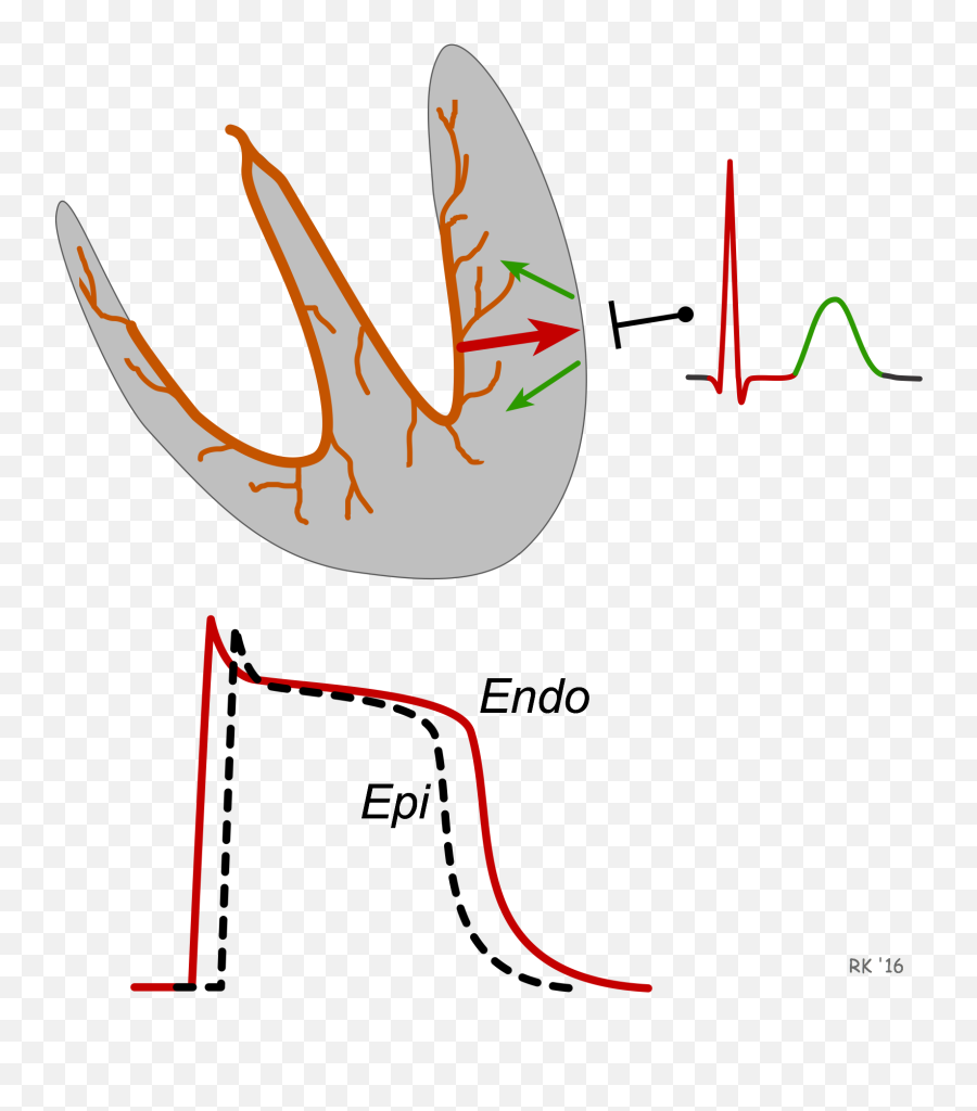 Ecg T Wave Formation - Dot Emoji,Ekg Emotions