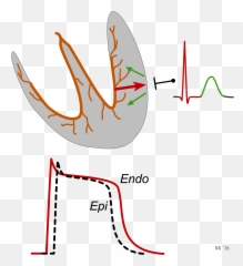 Ecg T Wave Formation - Dot Emoji,Ekg Emotions