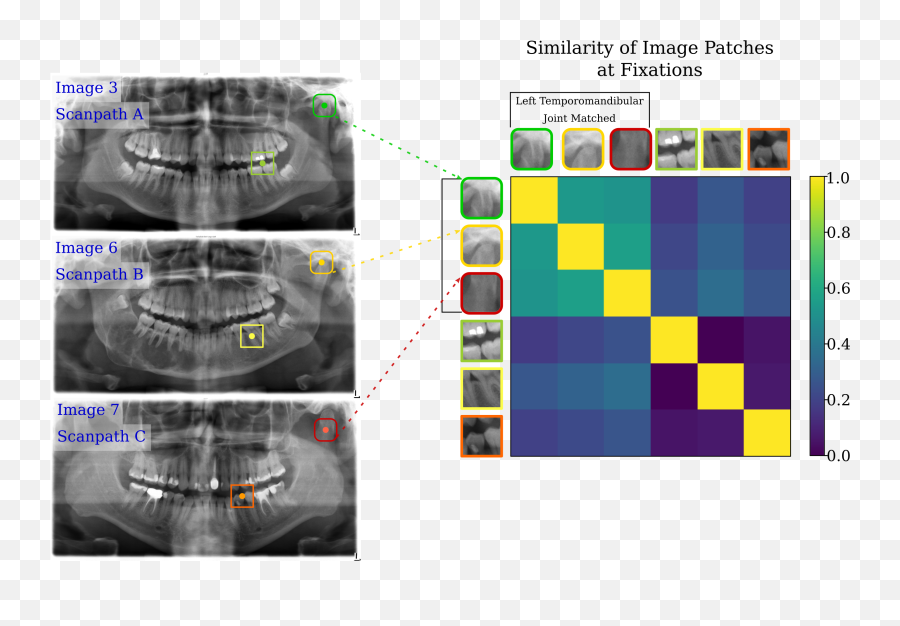 Deep Semantic Gaze Embedding And Emoji,X Ray Emoji