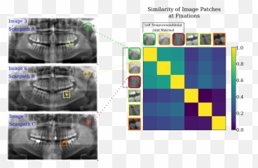 Deep Semantic Gaze Embedding And Emoji,X Ray Emoji
