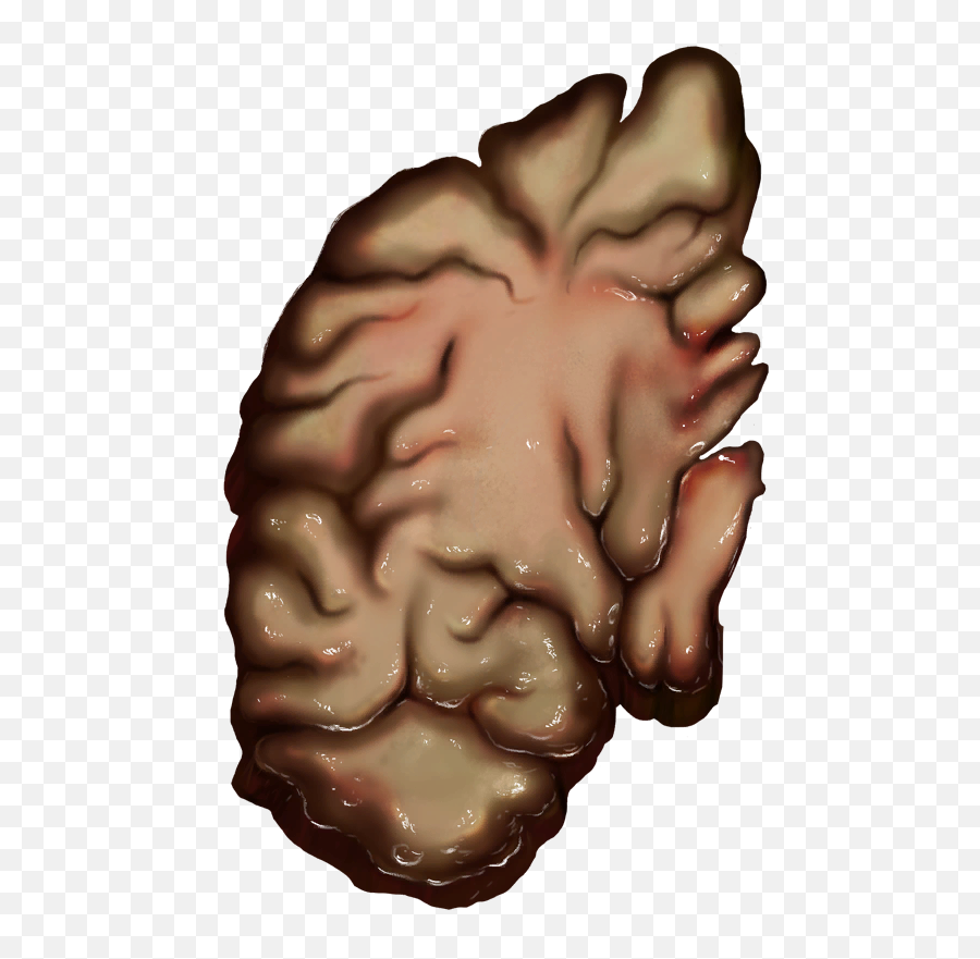 Brain - Official Pathologic Wiki Emoji,Anatomy Heart Emoji