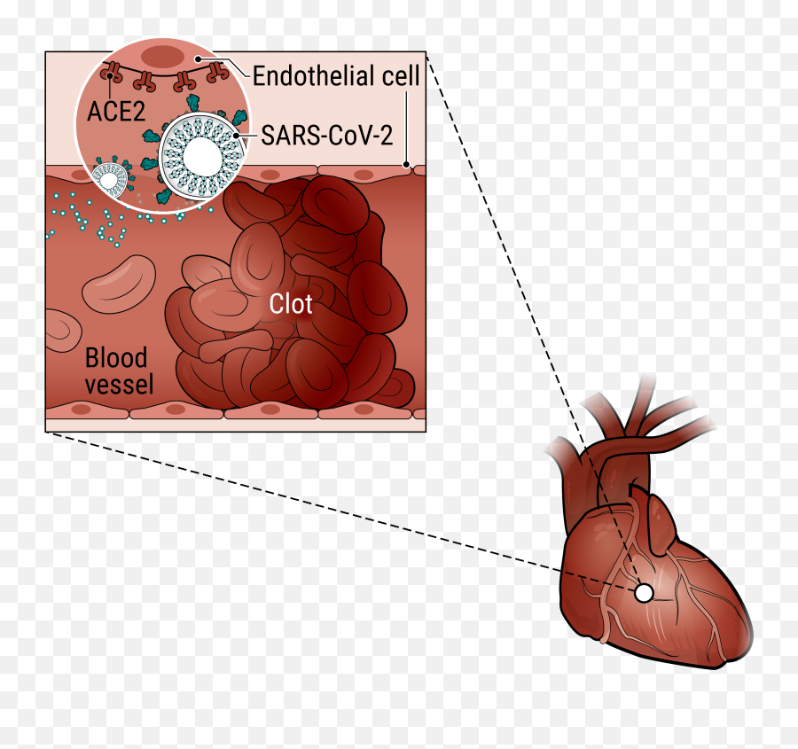 How Does Coronavirus Kill Clinicians Trace A Ferocious - Blood Emoji,How Your Emotions Affect Your Body Organs