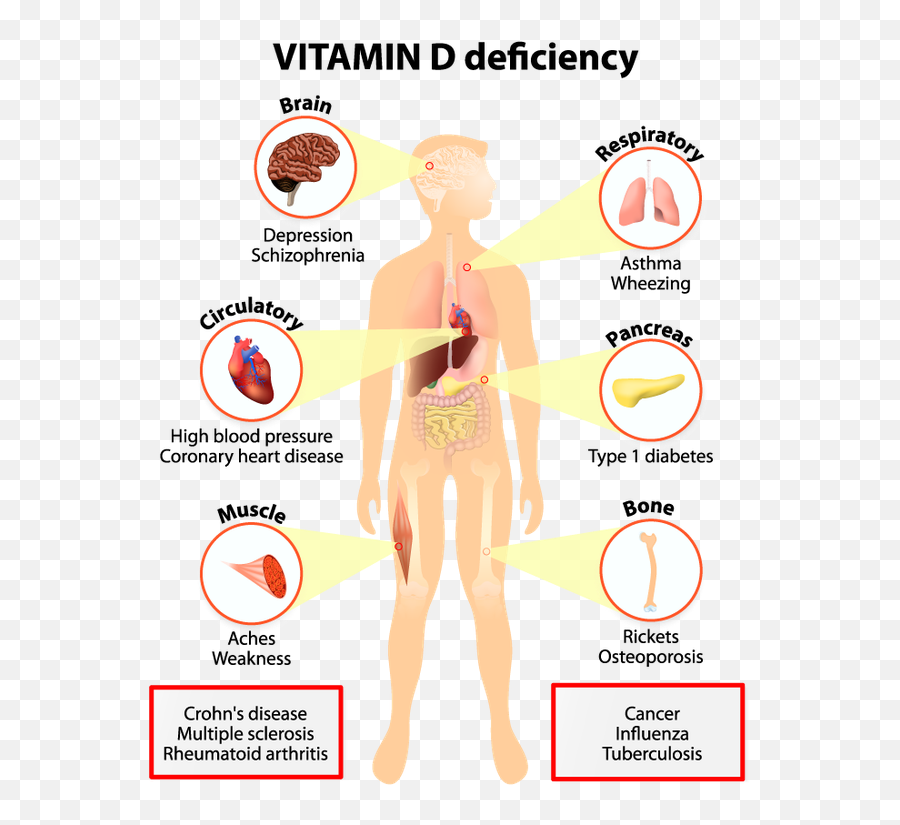 What Disease Is Caused - Vitamin D Deficiency Symptoms Emoji,Paramecium Eaten Emotion