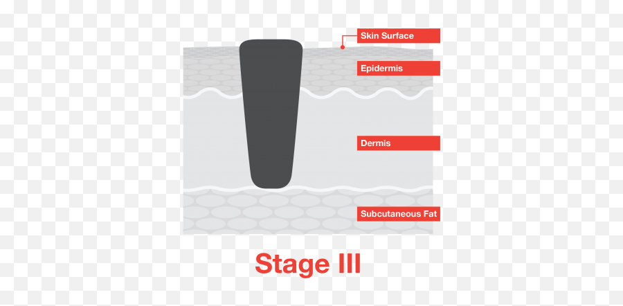 Stage 3 Melanoma - Stage 3 Nodular Melanoma Emoji,Emoticon |3