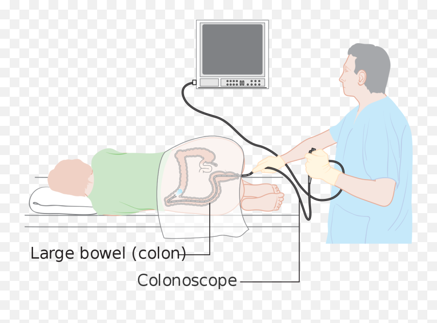 November 2017 - Colonoscopy Position Emoji,Colonoscopy Emoji