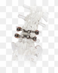 Marshall Health One Of 30 In Nation - Tops Premia Spine Emoji,Emoticons Back Pain