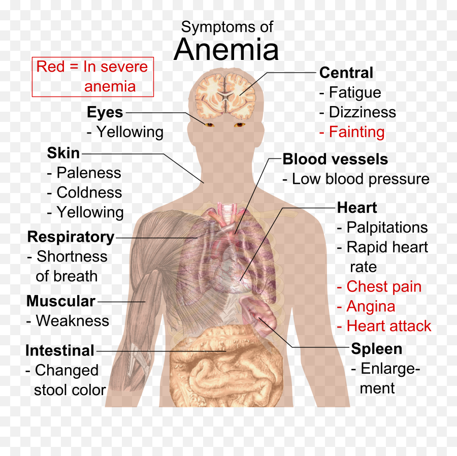 Blood Diseases And Disorders Boundless Anatomy And Physiology - Anemia Symptoms Emoji,Tooth Chart With Emotions And Organs Interrelated