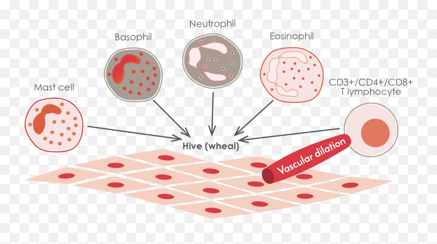 Disease Overview - Epidemiology Of Urticaria Hd Emoji,Weal With Emotion