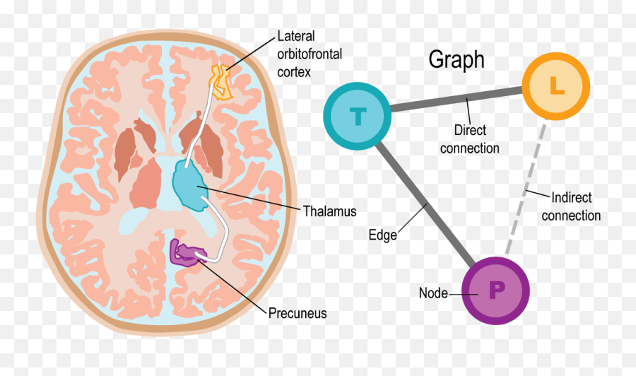 Introduction To Brain Connectivity And Disconnectivity Blog - Dot Emoji,Brain Anatomy Emotions