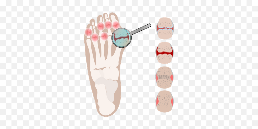 Toe Icon - Download In Flat Style Emoji,Toes Emoji