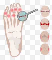 Toe Icon - Download In Flat Style Emoji,Toes Emoji
