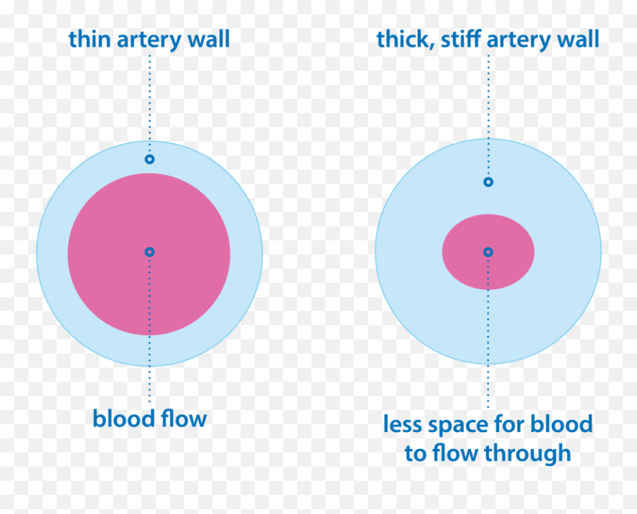 Causes Of Pulmonary Hypertension - Causes Pulmonary Hypertension Emoji,Raw Emotions After Blood Clot