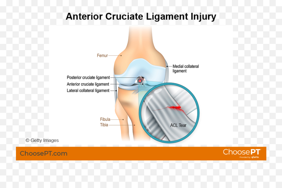 Guide Physical Therapy Guide To Anterior Cruciate Ligament Emoji,Emotion Pit Of Stomach Deep In Belly