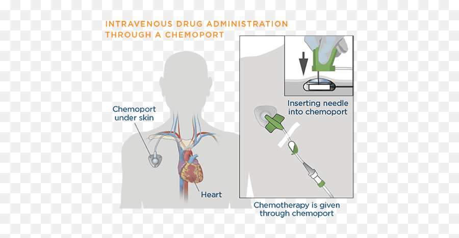 Chemotherapy Lungevity Foundation Emoji,Emotions Right.under The Skin