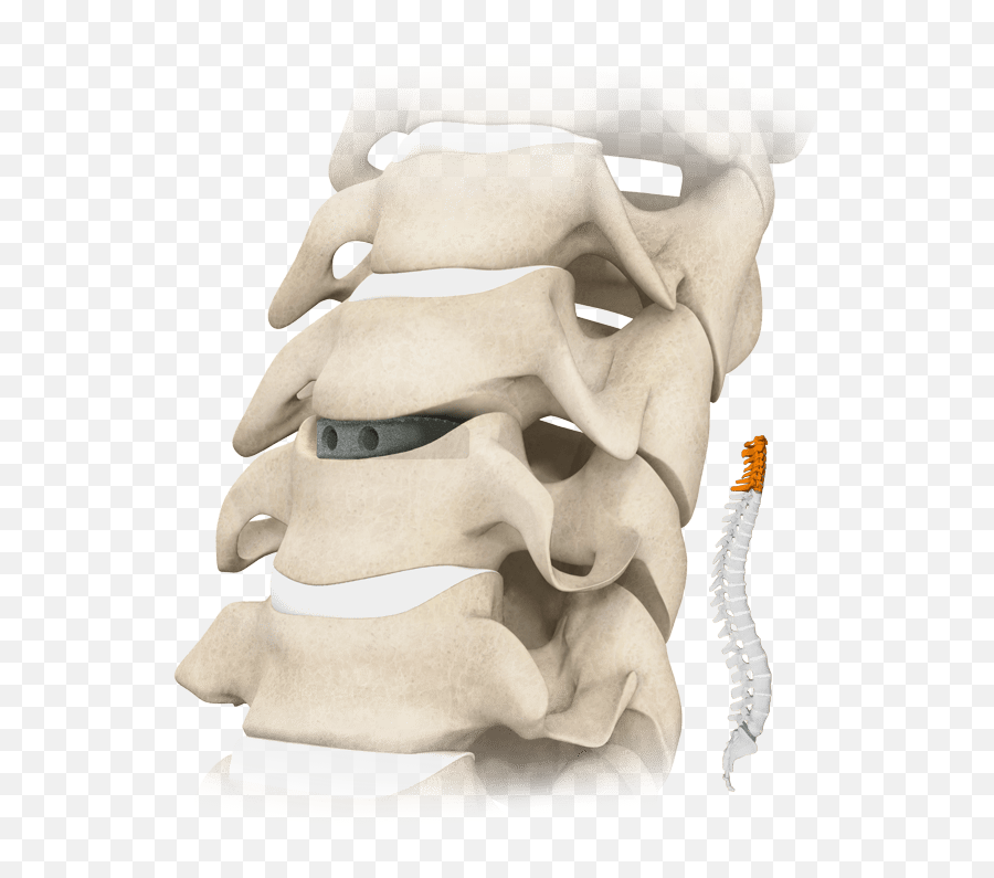 Neurostructures Cavetto Phusion Metal Emoji,Emotion Trap In The Spine