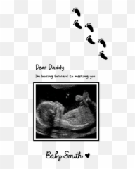Dear Baby - Ultrasound Phone Case Inkly Emoji,Holding Baby Emoji Apple