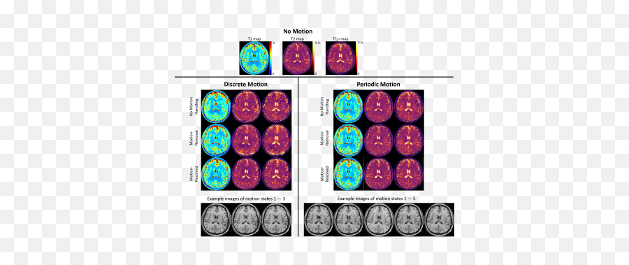 Quantitative Relaxation Parameter Mapping In The Brain Acq Emoji,Jaejin Cho Emotion