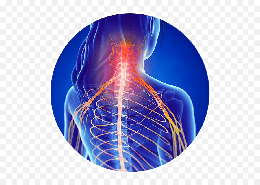 Do I Need A Spinal Cord Stimulator The Advanced Spine Center - Neck Pain And Stiffness Emoji,Emotion Trap In The Spine