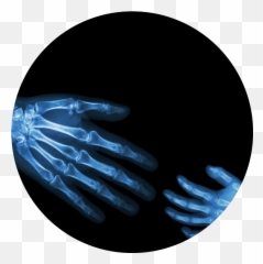 Northern California Pet Imaging Center - Bone Emoji,X Ray Emoji