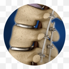 Do I Need A Spinal Cord Stimulator The Advanced Spine Center - Medical Supply Emoji,Emotion Trap In The Spine