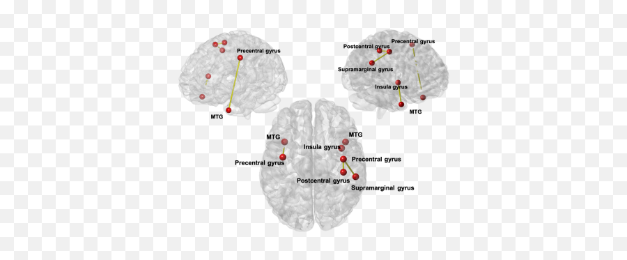 Ismrm19 Posters - Neuro Dot Emoji,Mtg Emotion Affecting Artifact