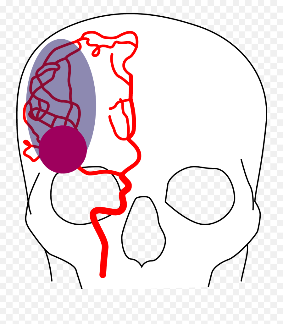 Clinuvel To Trial Innovative Drug In Stroke - Creepy Emoji,Tesla Song And Emotion