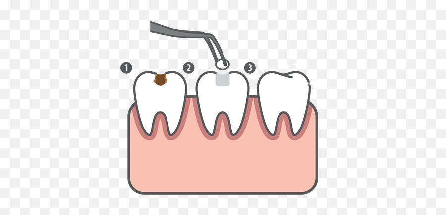 Restorative Dentistry In Houston Tx - Dassani Dentistry Emoji,Emoji Missing A Tooth