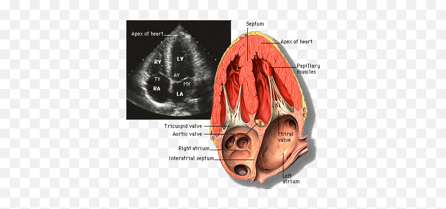 Inter Ventricular Septum Belongs To - Heart Anatomy Echocardiography Emoji,Septum And Emotion