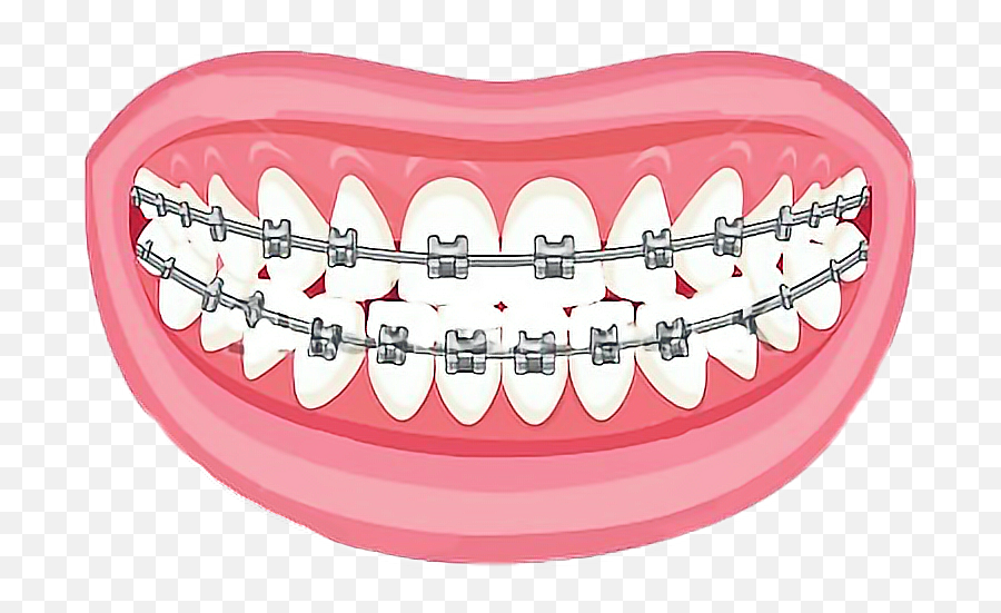 Ftestickers Braces Freetoedit Sticker By Bootattoo - Orthodontist Vector Emoji,Pics Of Emoji Teeth With Braces