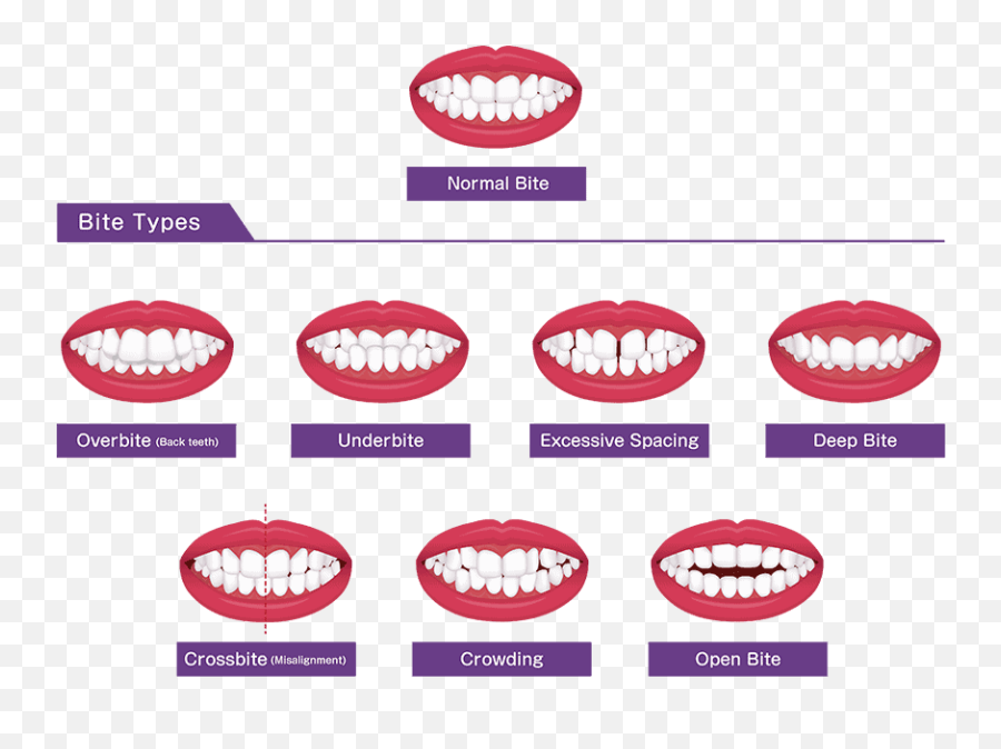 Tooth Extraction - Cutting Edge Periodontist Emoji,Bite Lip Emotion