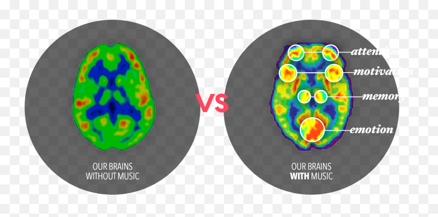 Home - Muzology Brains Reaction To Music Emoji,Music And Emotion