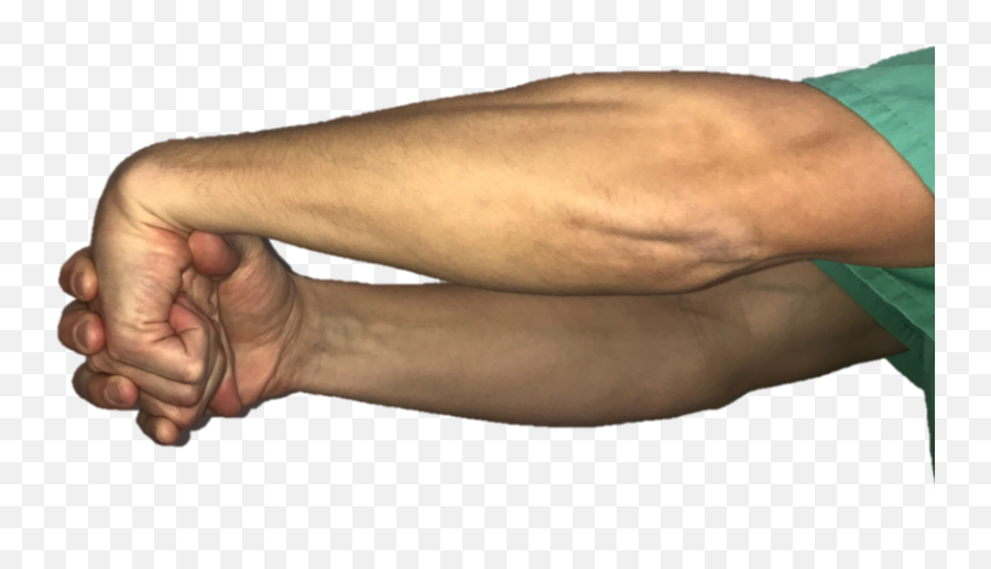 Tennis Elbow - Lateral Epicondylitis Raleigh Hand Surgery Fist Emoji,Ring.finger Pain Emotion