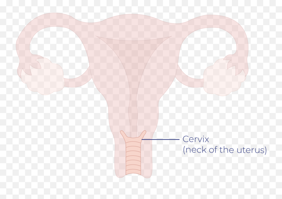 Cervical Cervix Cancer Signs And Symptoms Talk Peach - Cattle Emoji,After A Hysterectomy Will My Emotions Be Goofy