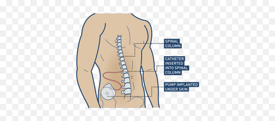 Home U2013 Kevinu0027s Care Emoji,Peope With Spinal Cord Injury ___ On The Spine Report ____ Intense Experiences Of Emotion